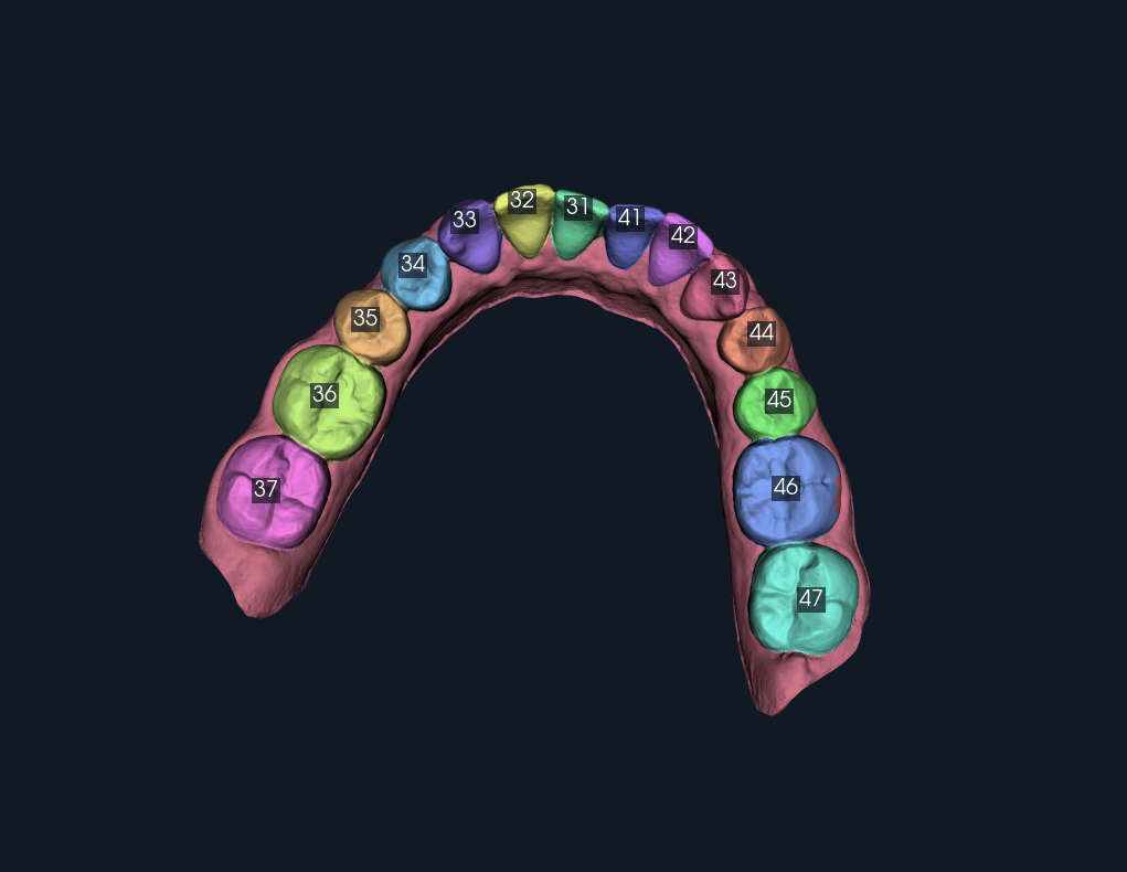 Tooth Studio application view with individual teeth separated by colour and identified by FDI labels